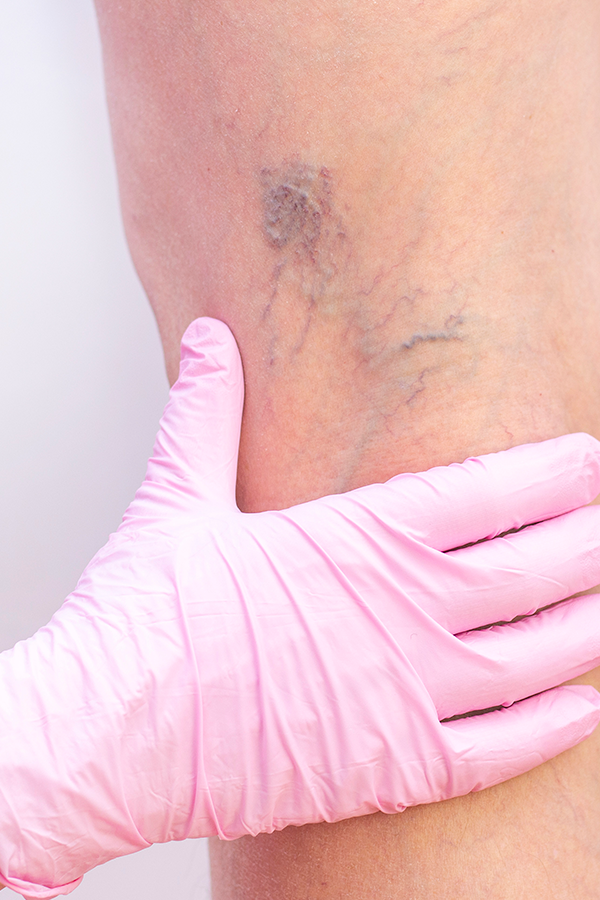 Especialista em Angiologia e Cirurgia Vascular da Clínica da MarcIA